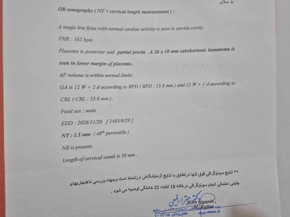 اینم سونو هست 