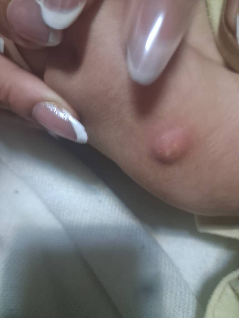 دست بچه دوماه چرا اینجوری شده؟