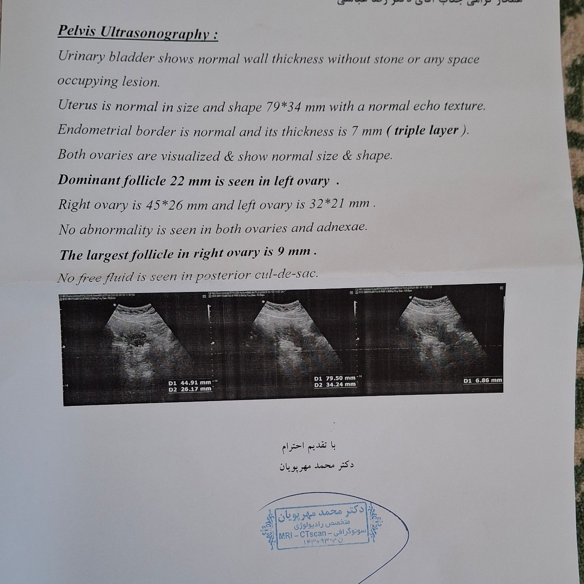 سایز فولیکول بالا خانم دکتر