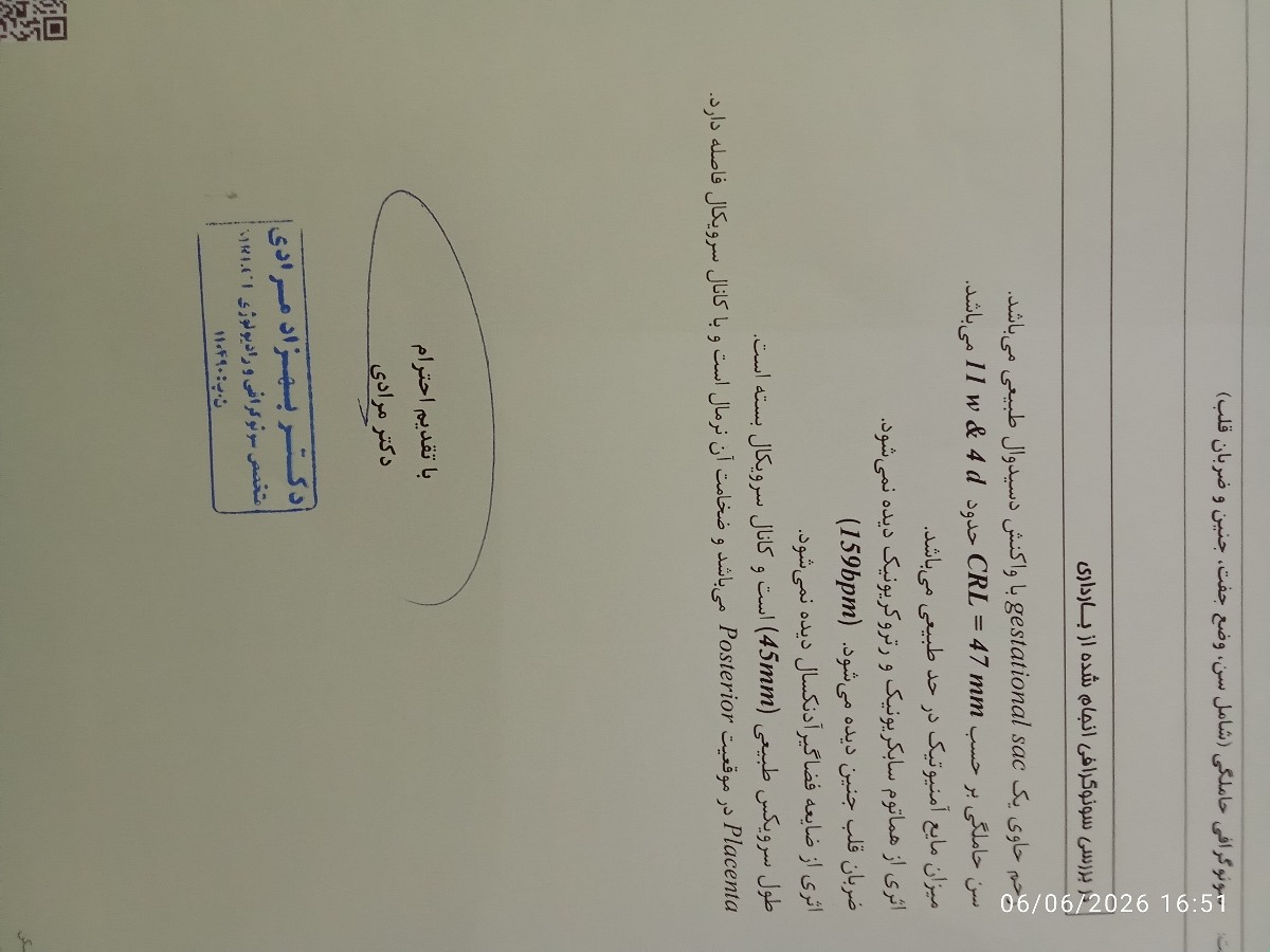 این سونو در تاریخ ۱۴۰۵/۳/۱۵ انجام شده