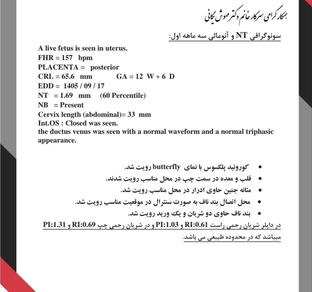 تفسیر سونوی ان تی