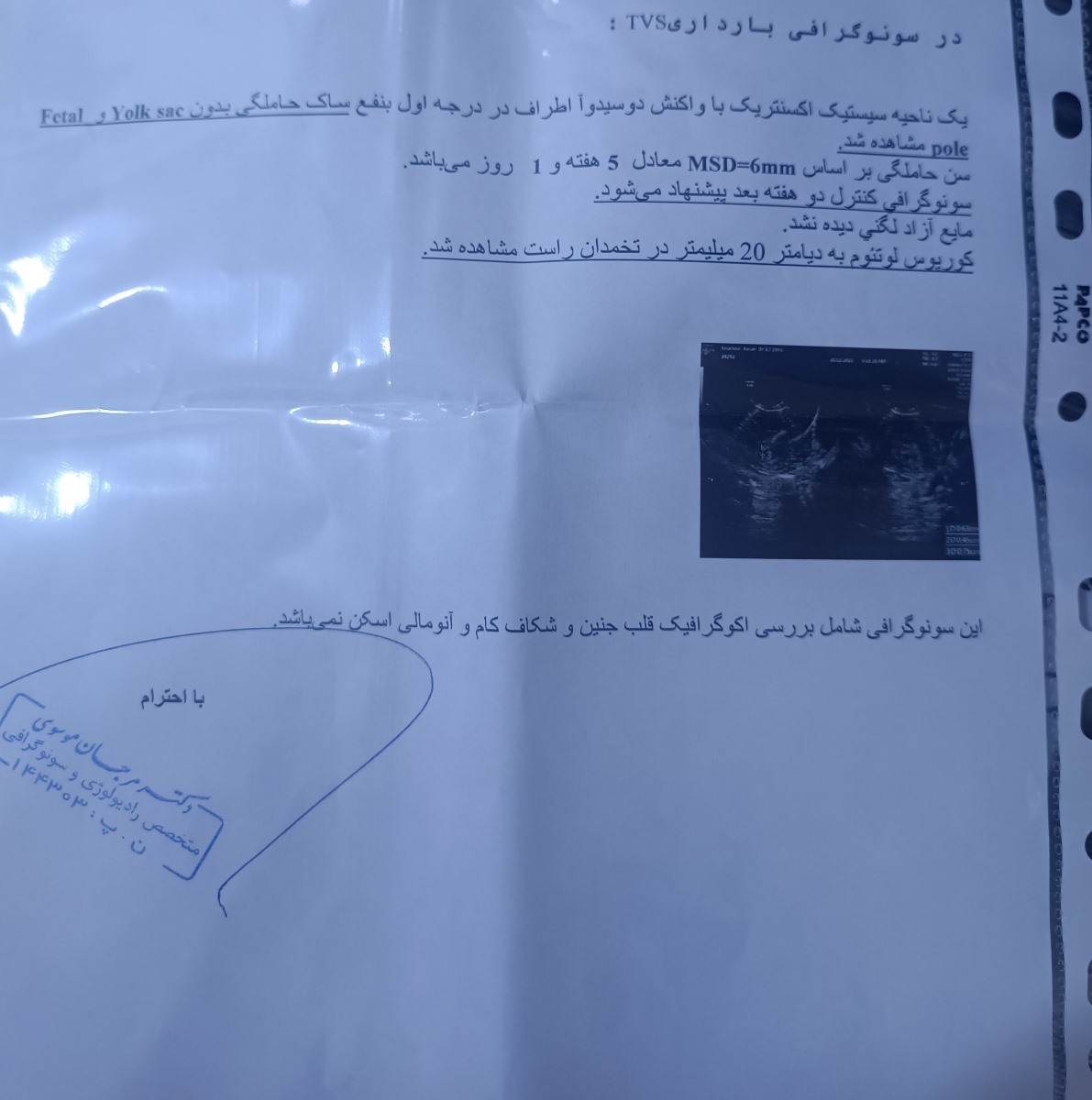 سونوی بارداری و نتایج سونوی بارداری و نتایج