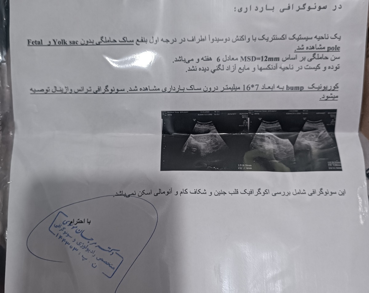 اینم سونوی امروز اینم سونوی امروز