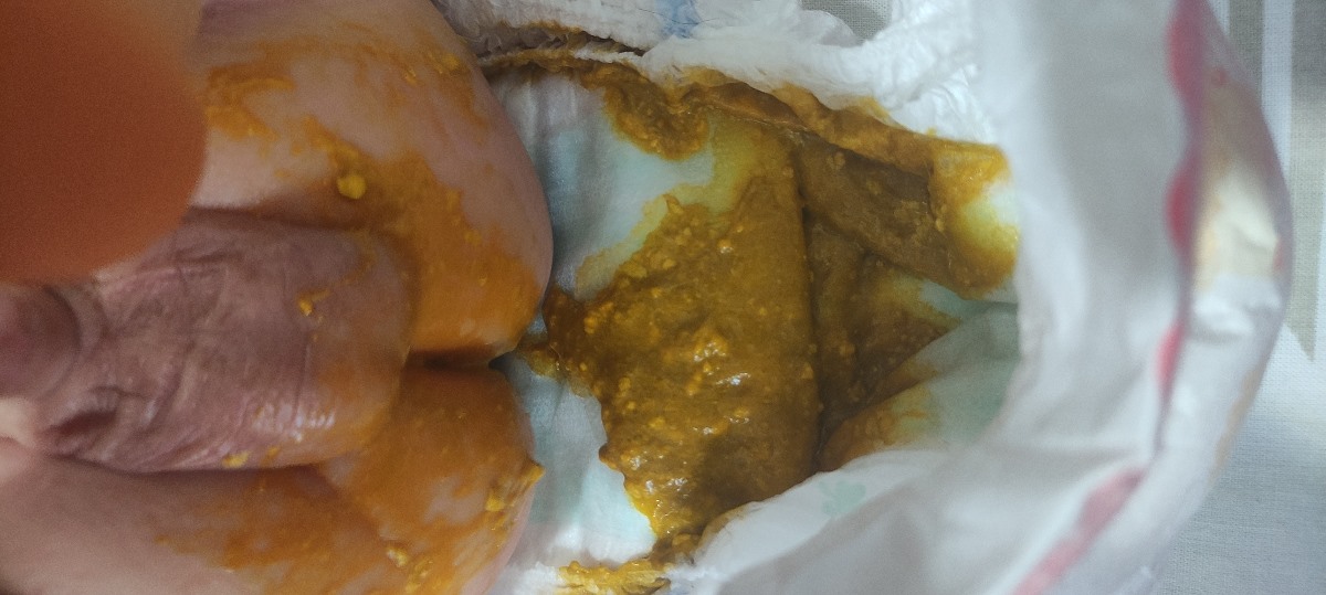 عکس مدفوع نوزاد