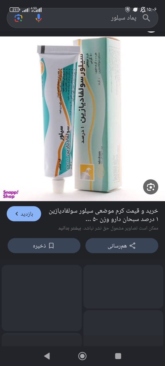 سوختگی با آب جوش سوختگی با آب جوش