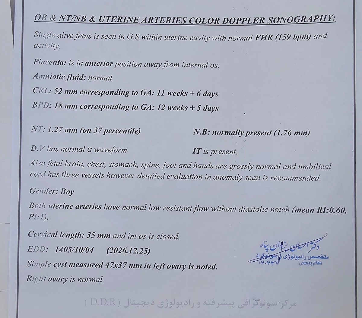 تفسیر سونوی ۱۲ هفته + عکس