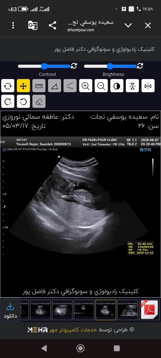 سونو nt رو ببین و حدس بزنین جنسیت رو