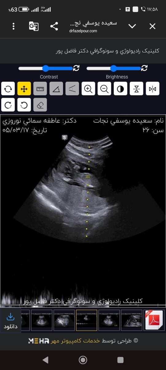 سونو nt رو ببین و حدس بزنین جنسیت رو
