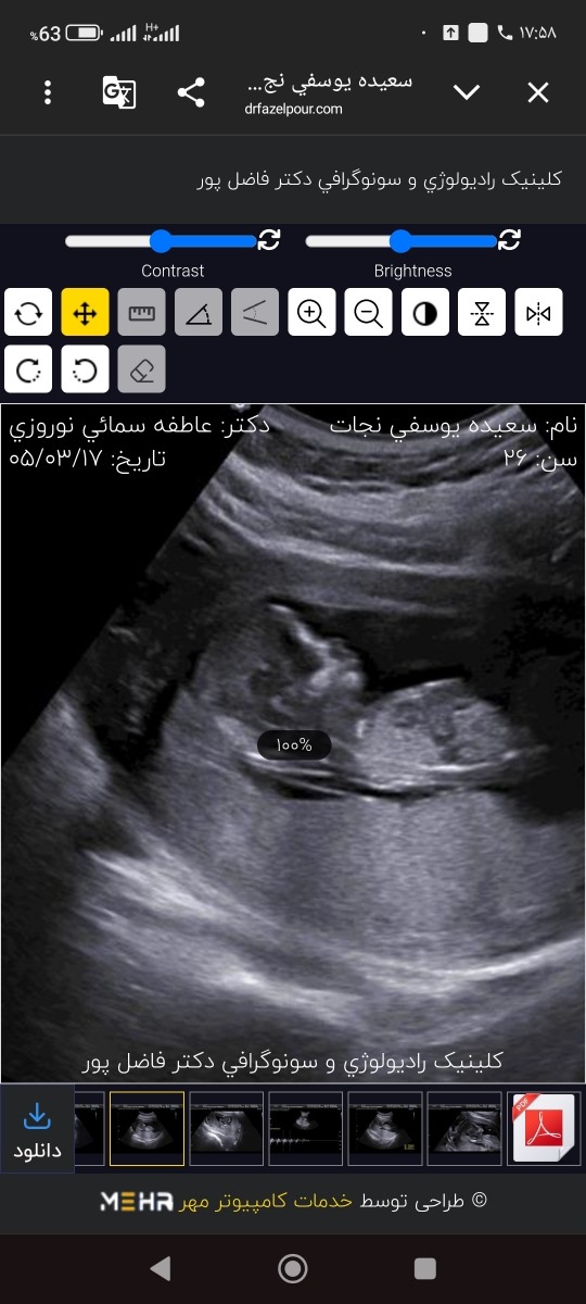 سونو nt رو ببین و حدس بزنین جنسیت رو