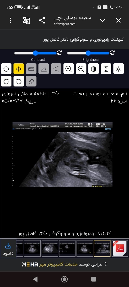 سونو nt رو ببین و حدس بزنین جنسیت رو