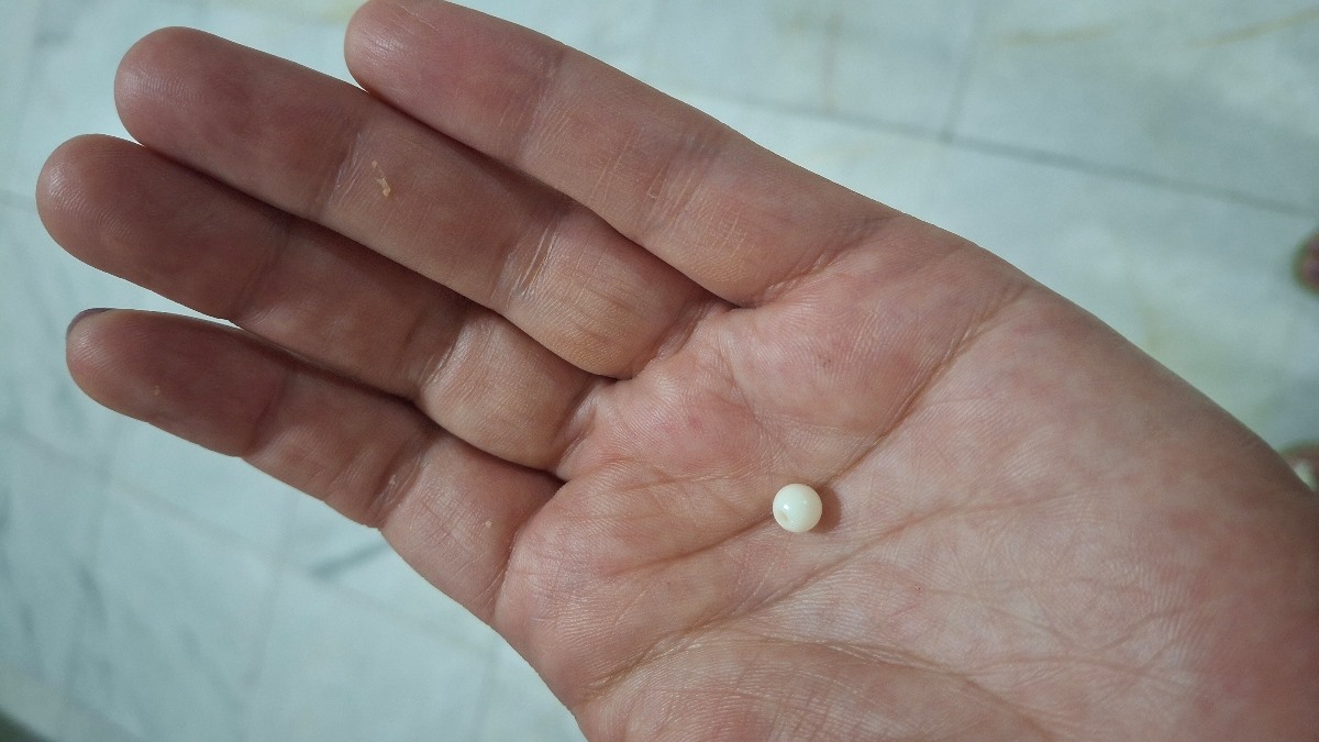 مهره ریز داخل بینی دخترم