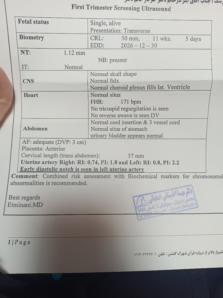 سلام خانوما منم رفتم سونو ان تی
