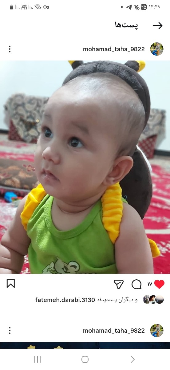 اینم ضربه گیر برا سرش اینم ضربه گیر برا سرش