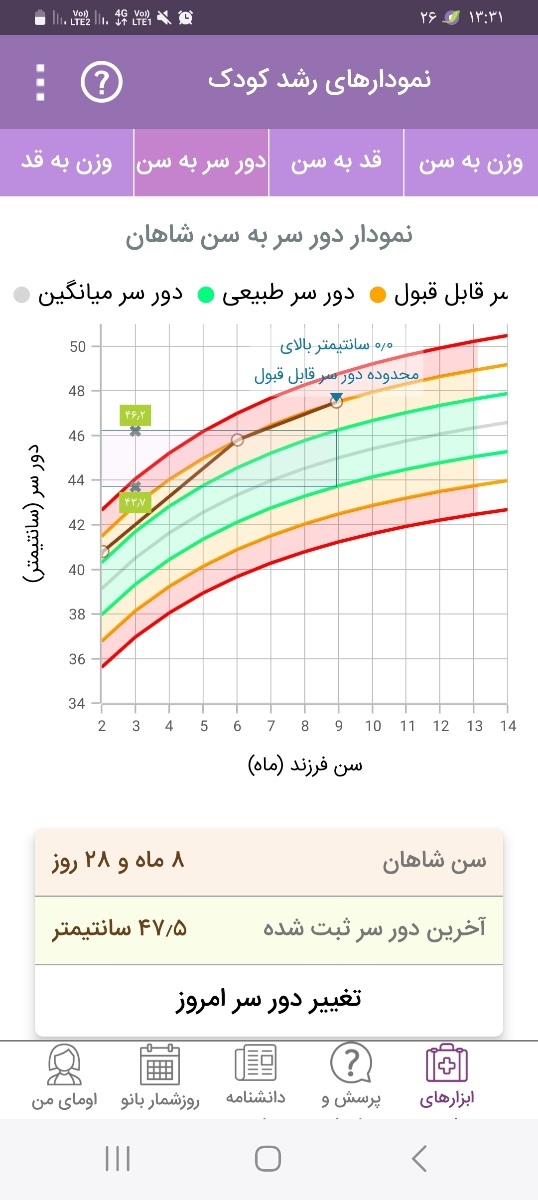 ❌ فوری بزرگ بودن دورسر نوزاد❌ ❌ فوری بزرگ بودن دورسر نوزاد❌