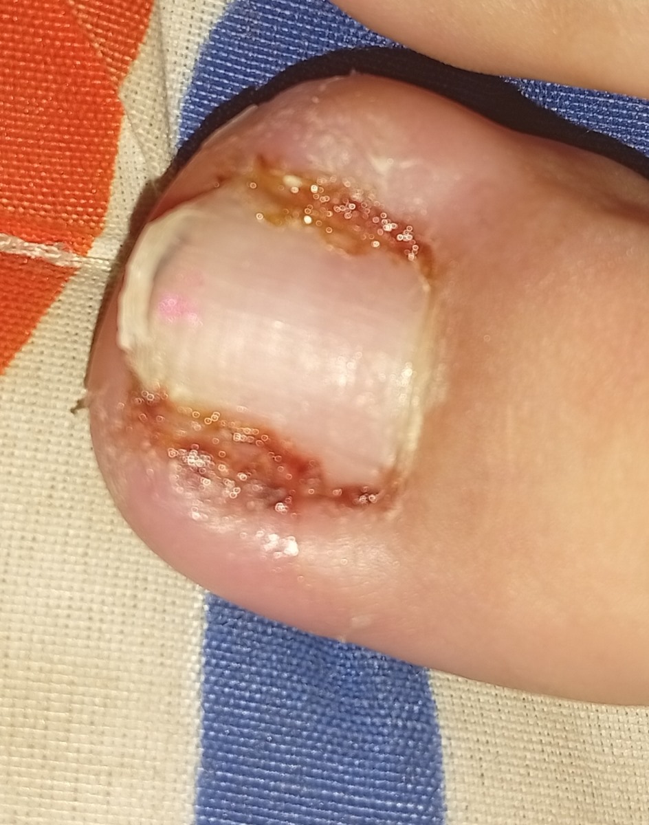 😓اوضاع من بدتره هرکارم میکنم خوب نمیشه دیگه خسته شدم اگه راهی پیدا کردی دوایی درمونی به منم بگو😒 😓اوضاع من بدتره هرکارم میکنم خوب نمیشه دیگه خسته شدم اگه راهی پیدا کردی دوایی درمونی به منم بگو😒