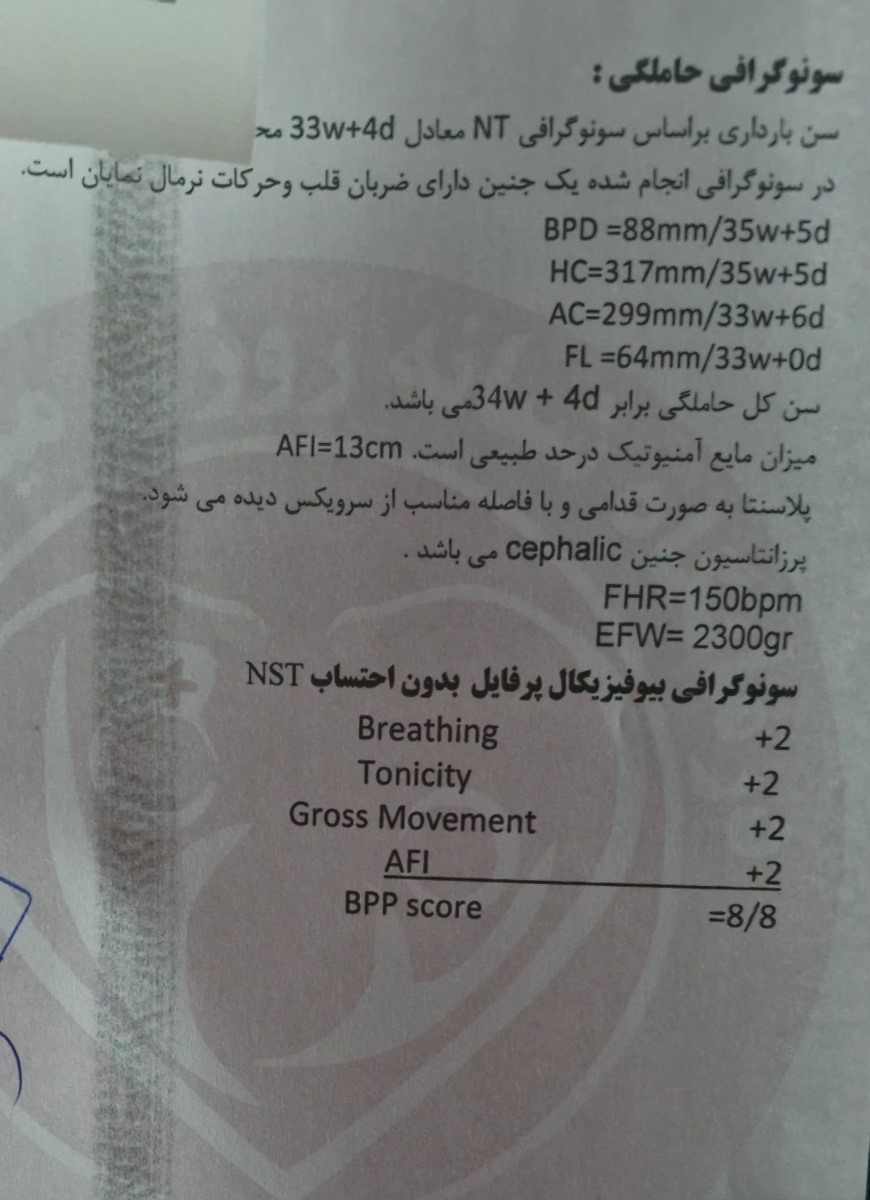 تفسیر سونو هفته ۳۳ و ۴روز