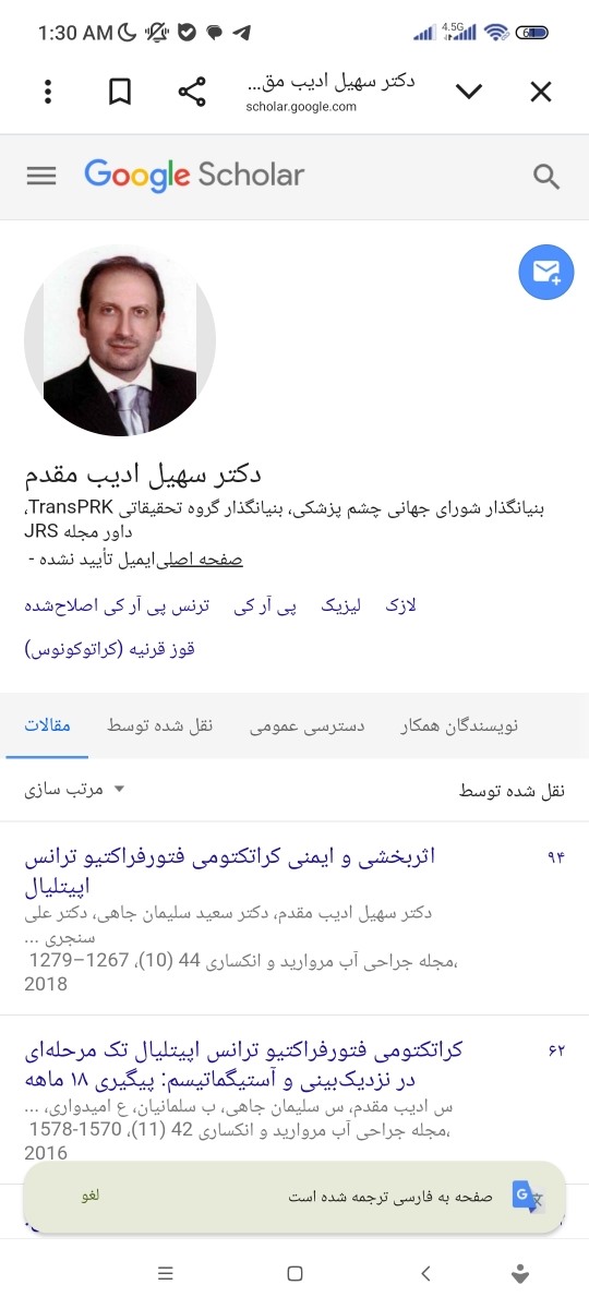 عمل لیزیک و لازک