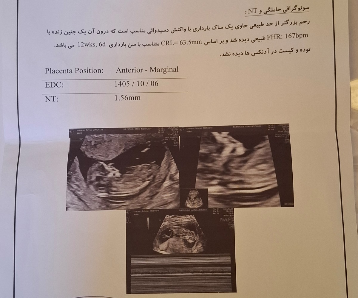 تفسیر سونو و ازمایش انتی