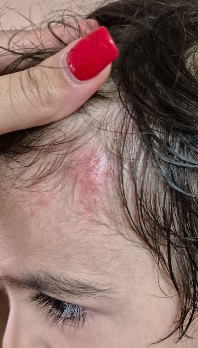 سلام خ دکتر قرمزی پوست سر پسرم