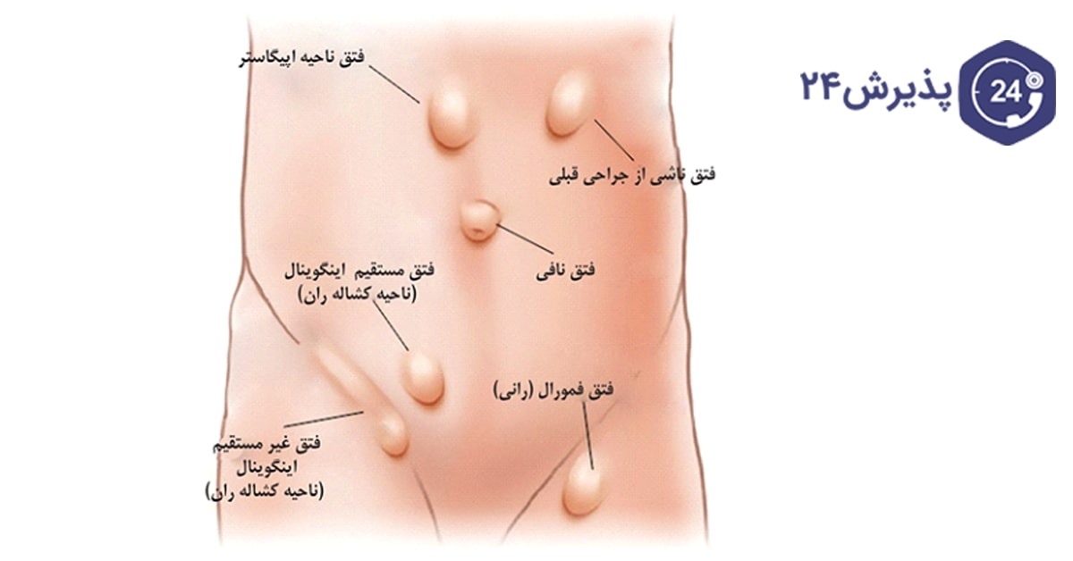 بحق این شب عزیز هز کک میتونه واسه بابام یه زیارت عاشورا بخونه