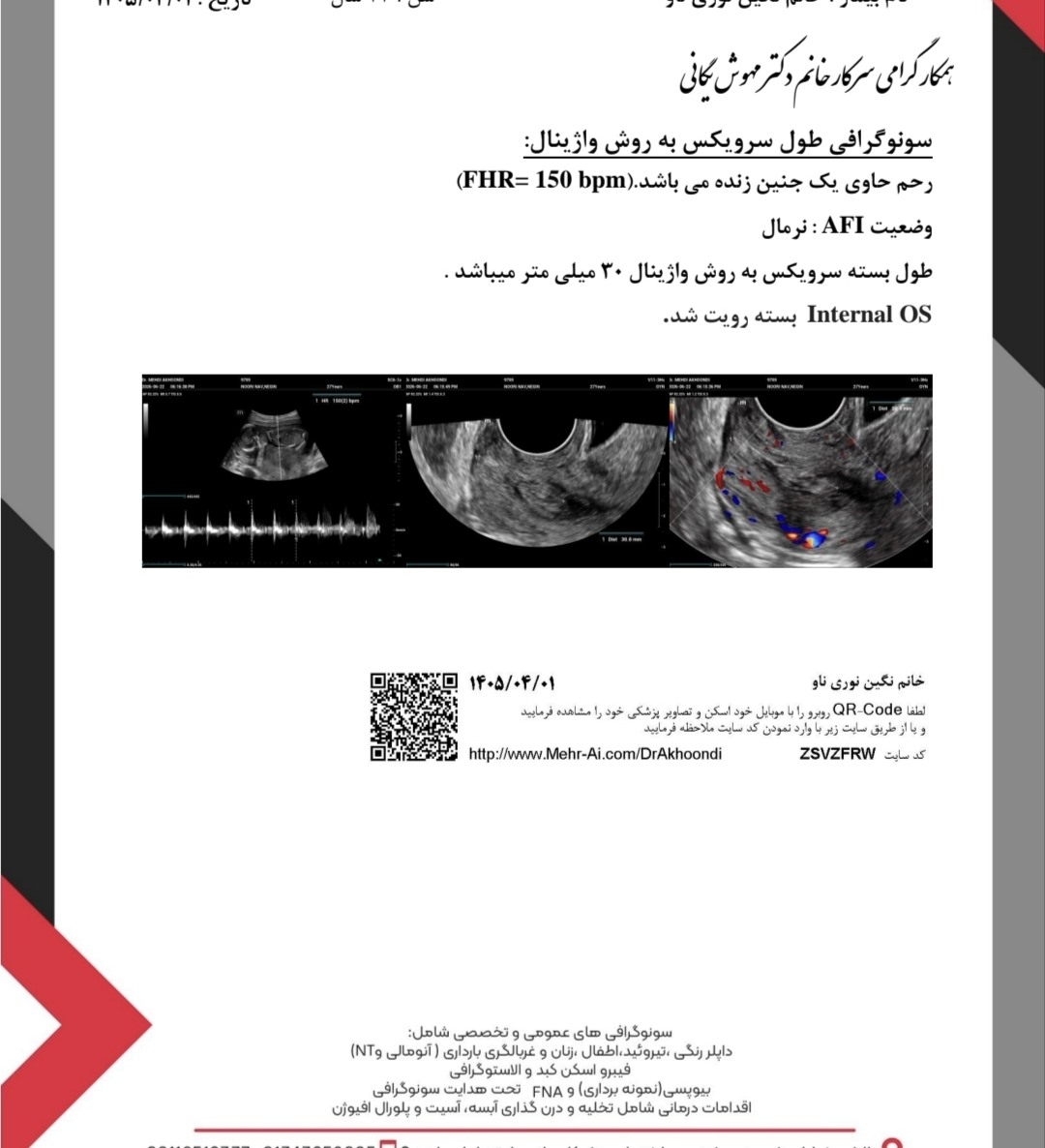 سونوگرافی طول سرویکس در هفته شانزدهم بارداری