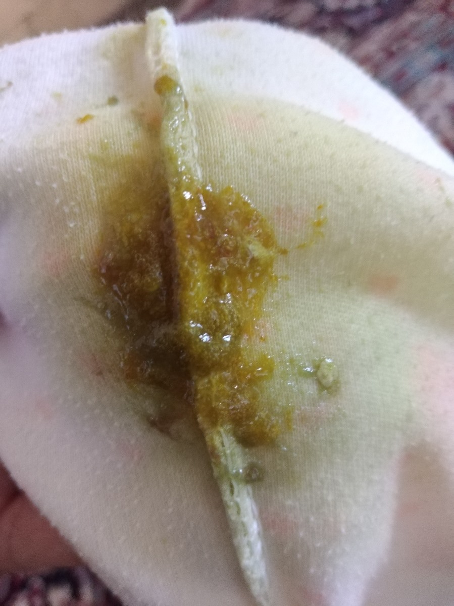 مدفوع امروز نوزاد