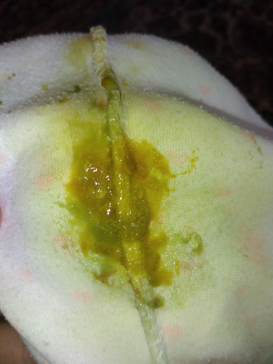 مدفوع امروز نوزاد