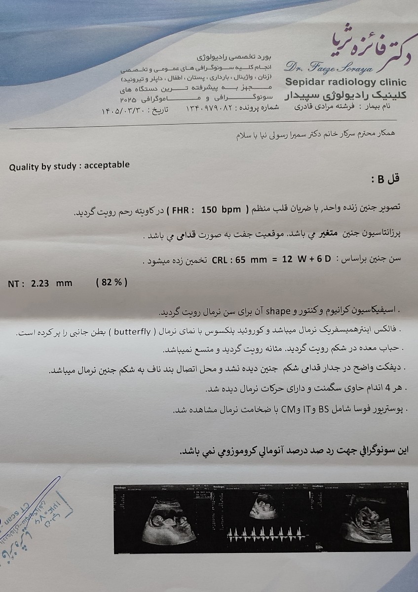 سونوگرافی غربالگری اول و عدد nt سونوگرافی غربالگری اول و عدد nt