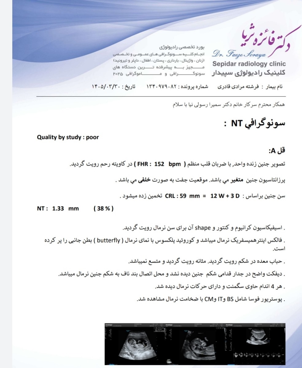 سونوگرافی غربالگری اول و عدد nt سونوگرافی غربالگری اول و عدد nt