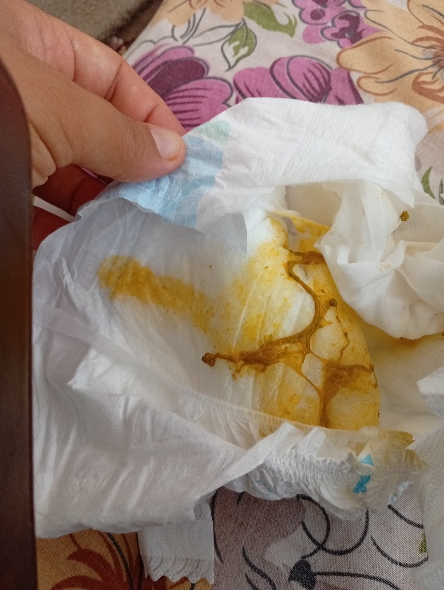 سلام دکتر جان مدفوع نوزادم یجوری شده