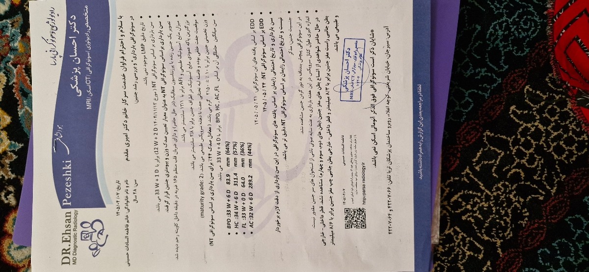 سونو گرافی هفته ۳۳