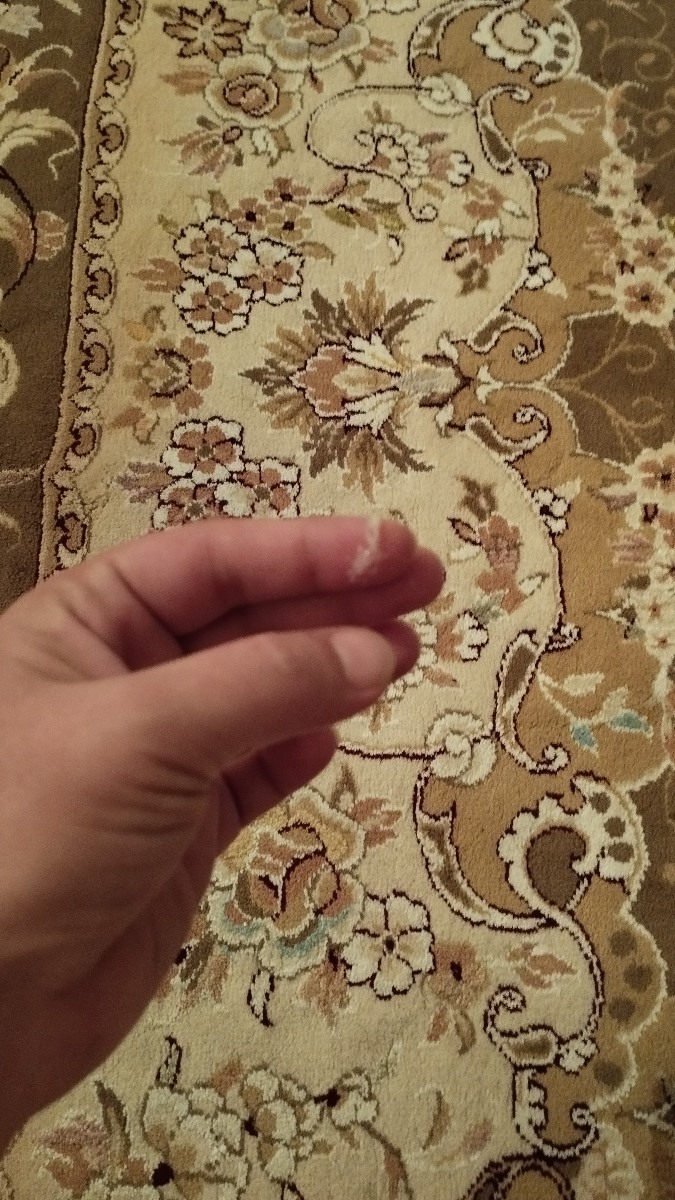 ترشح کش دار نشانه چیست