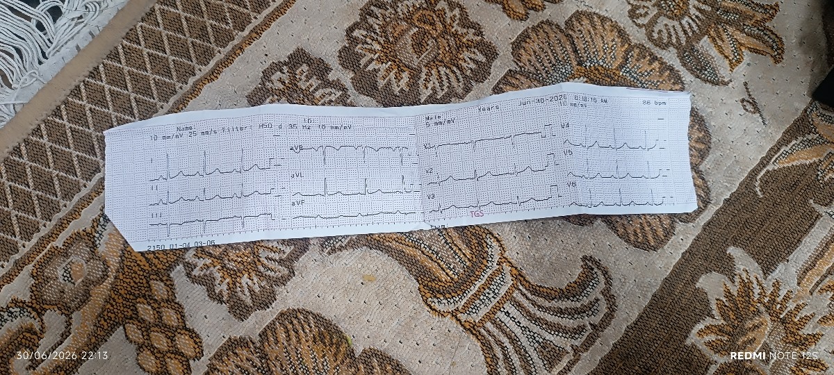 جواب اکوی قلب مادر شوهر