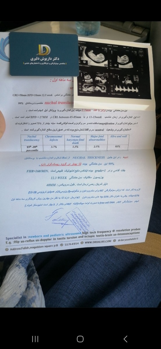 سونوی ان تی جنین.