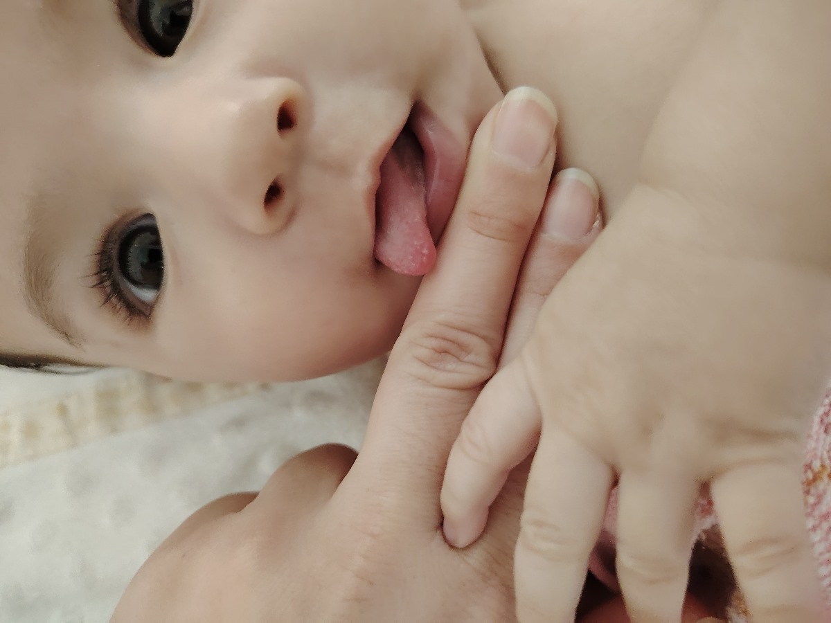 برفک دهان نوزاد