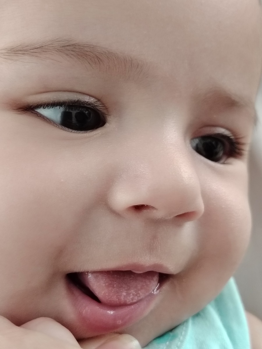 برفک دهان نوزاد