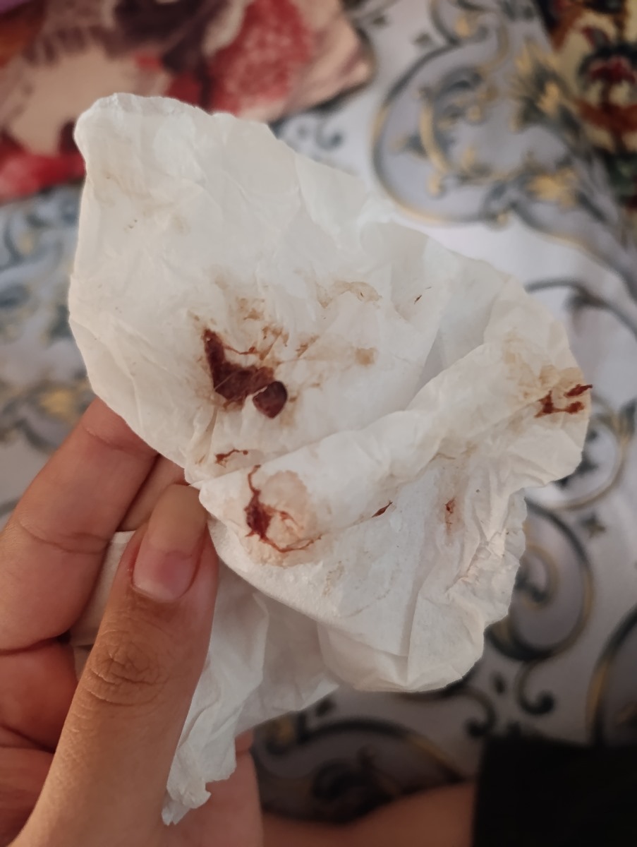 دفع لخته هفته ده ❌حاوی عکس ❌