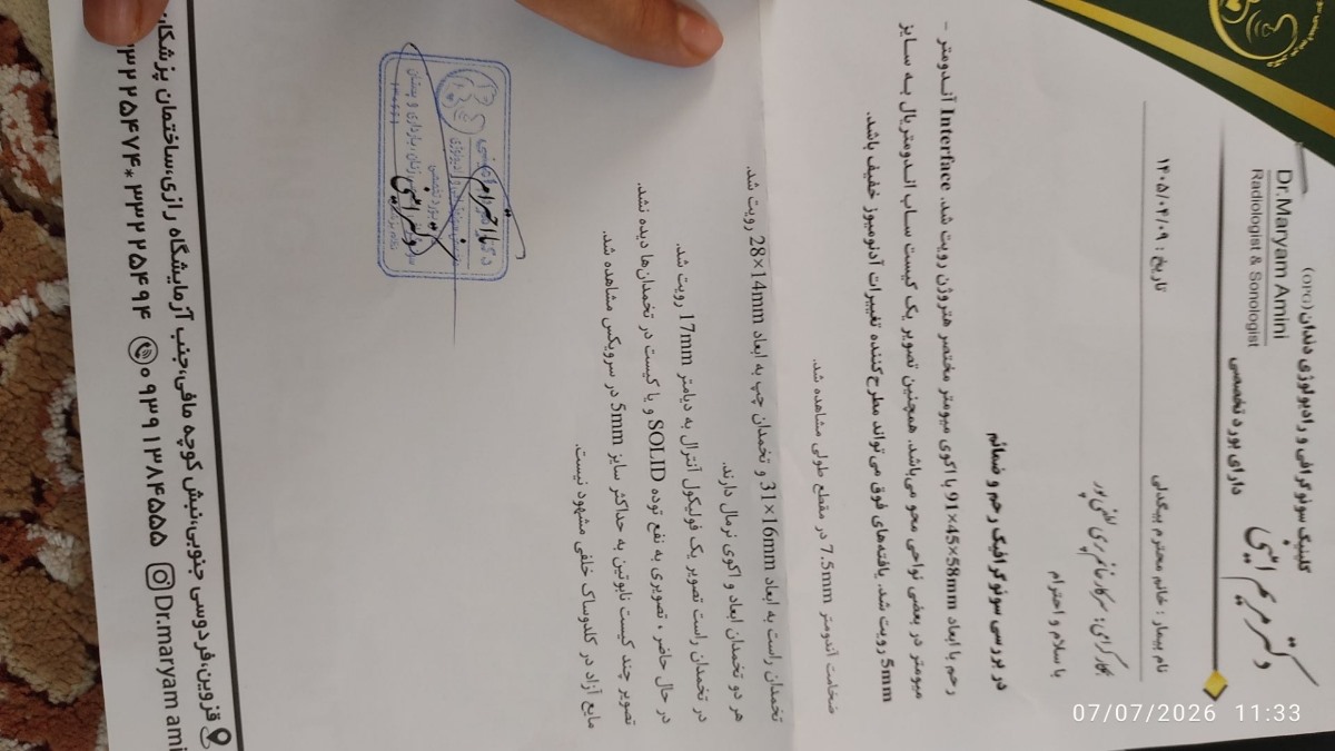 سونو