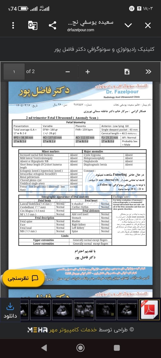 سونو آنومالی خوبه ب نظرتون مشکلی نیست