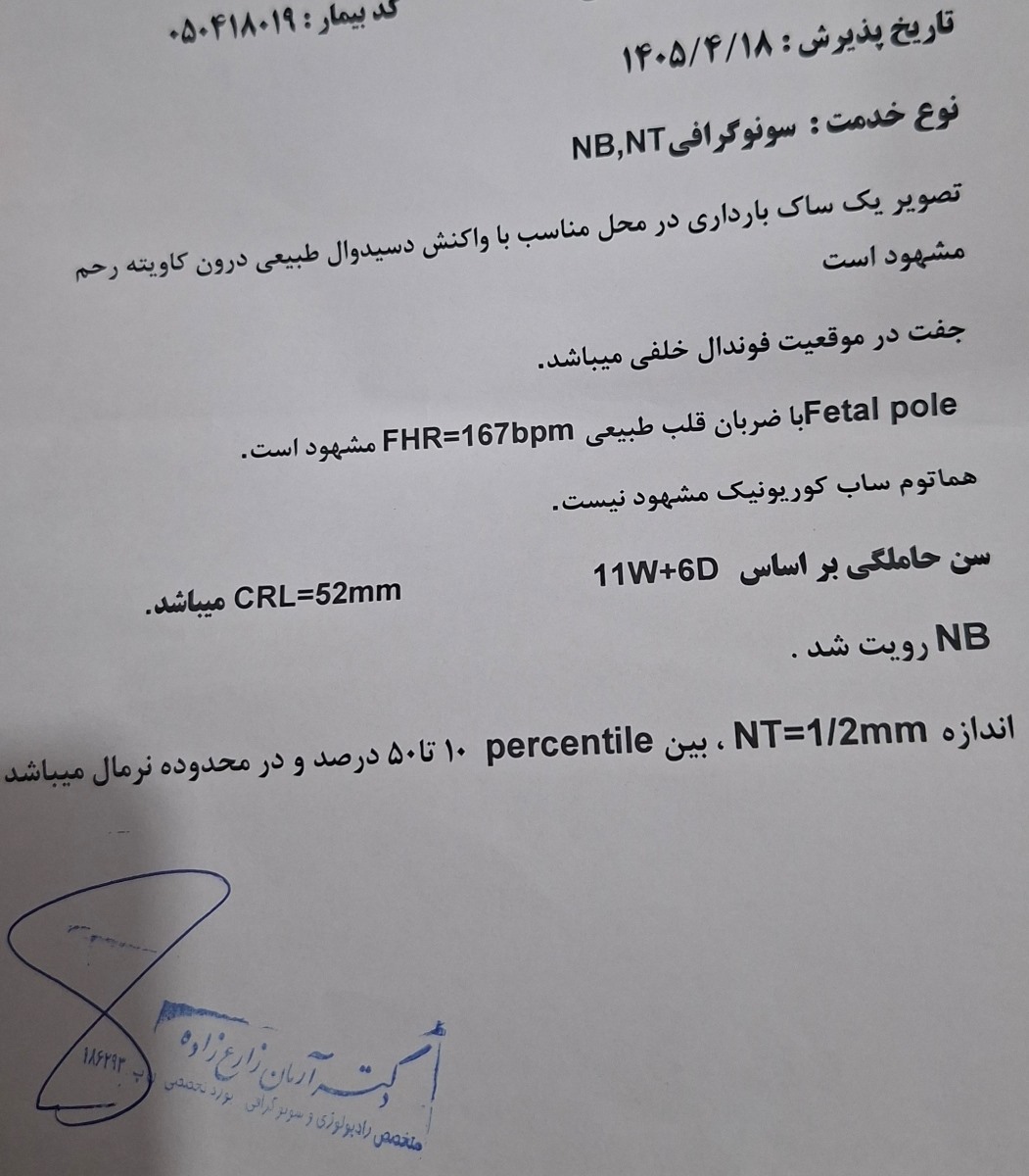 تفسیر سونو ان تی