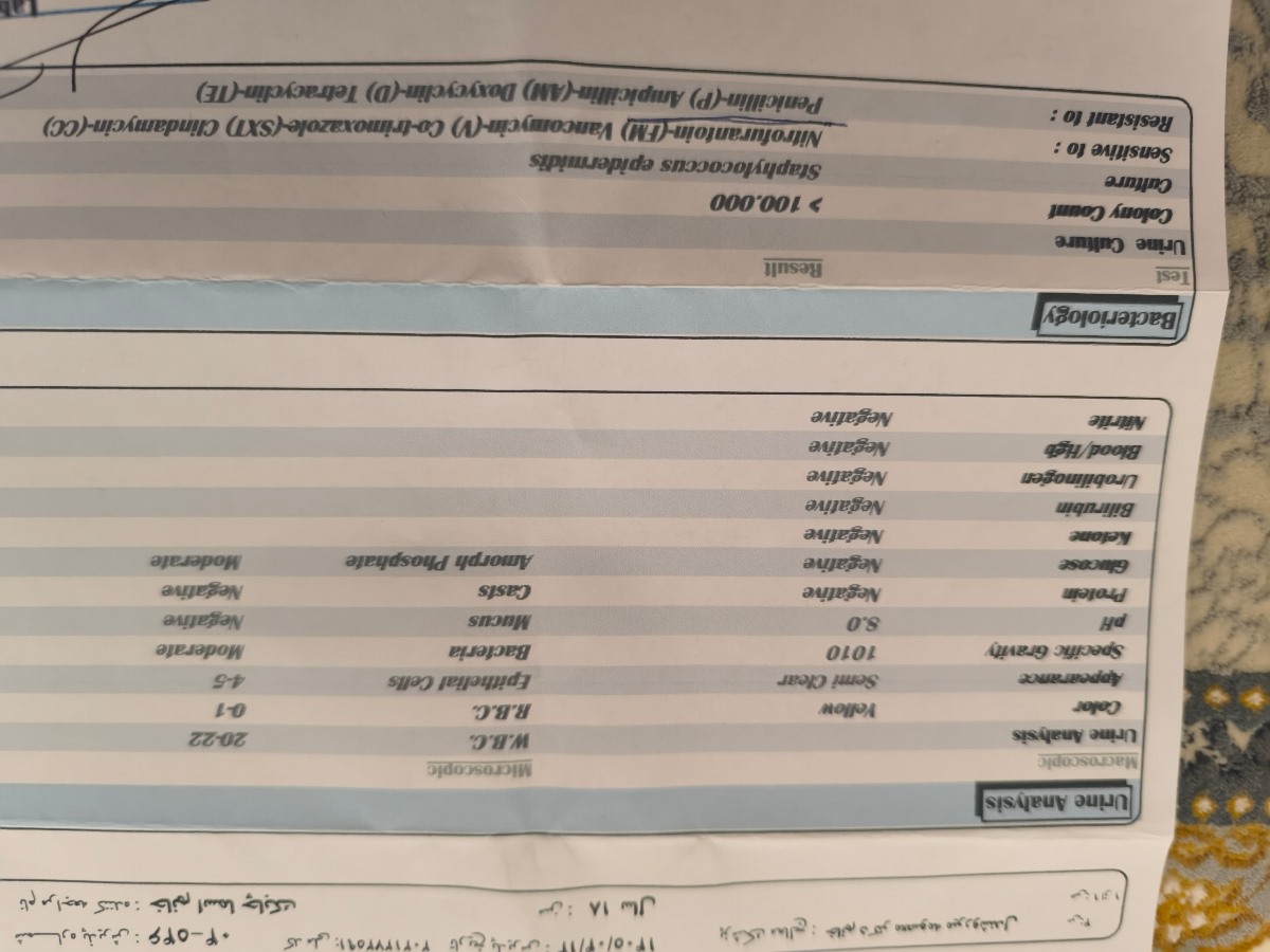 دومین آزمایش دومین آزمایش