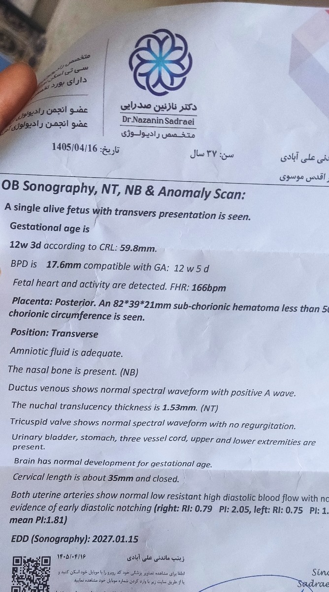 سونو آن تی 