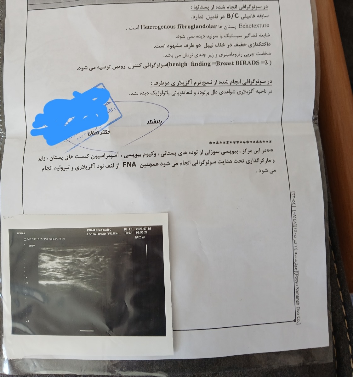 خانم دکتر سونو سینه