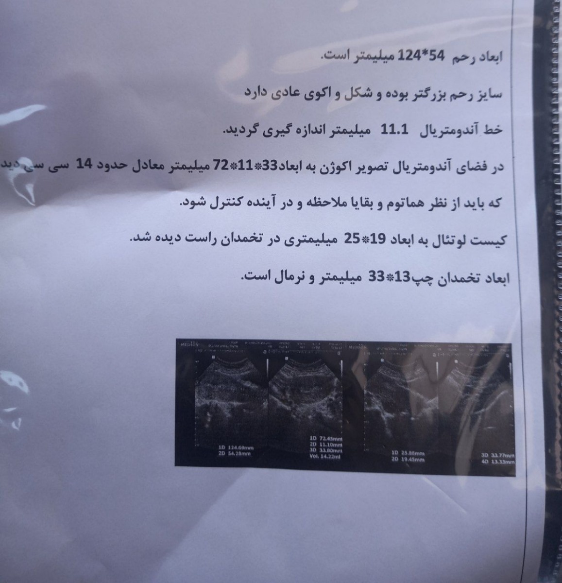 سونوگرافی اولم 
۱۴ روز قبل