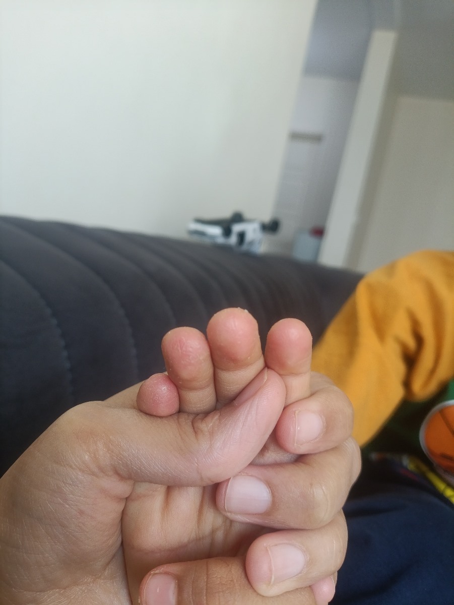 عکس دست پسر ۵ ساله