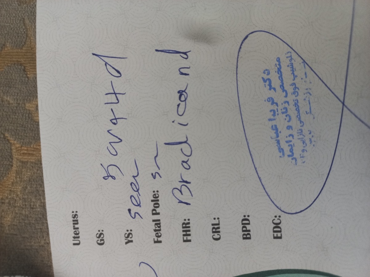 کپسول تاکرولیموس ۱میلی گرم
