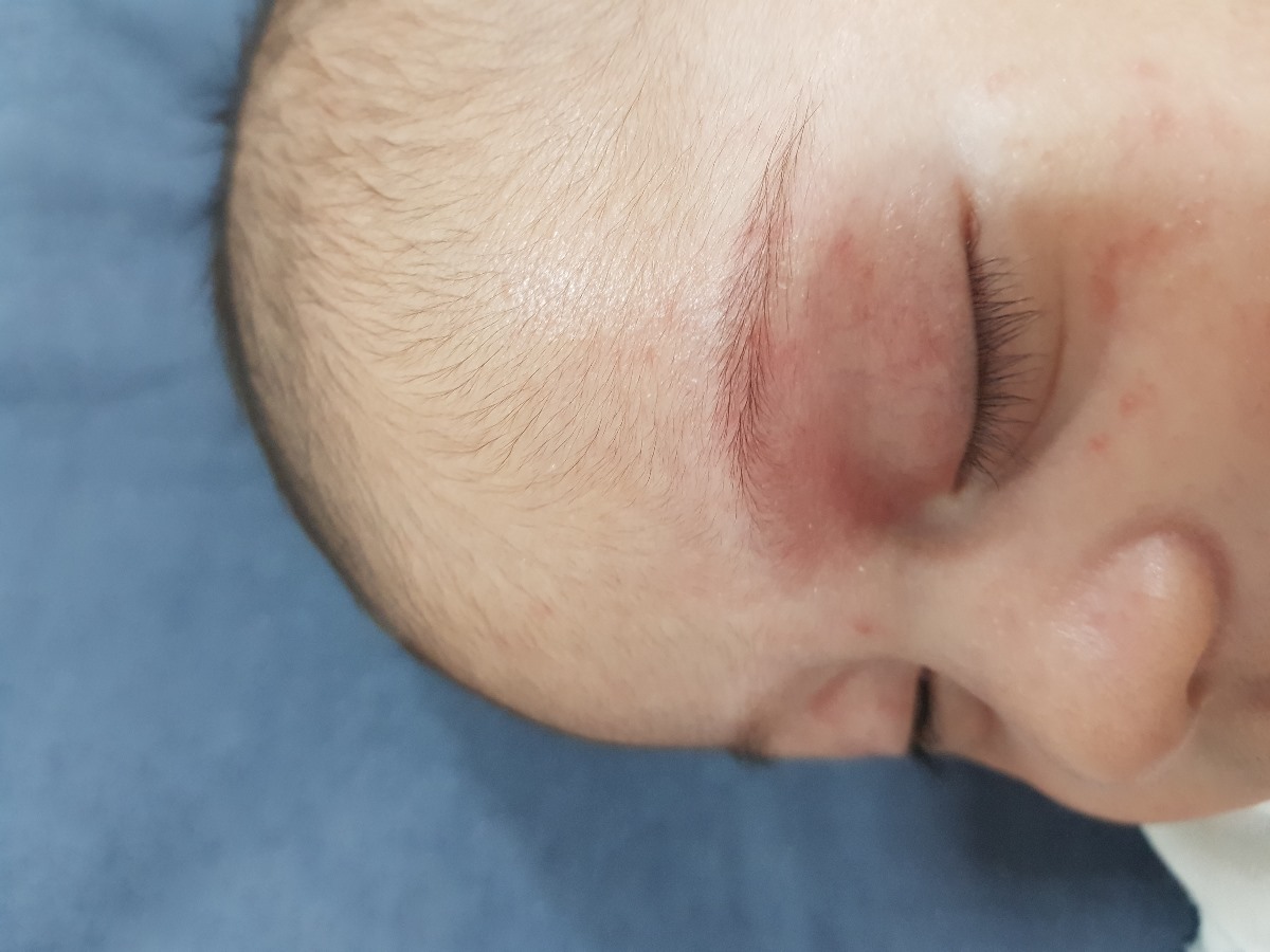 مالیدن صورت و بینی توسط نوزاد ۲ ماههه با عکسس مالیدن صورت و بینی توسط نوزاد ۲ ماههه با عکسس