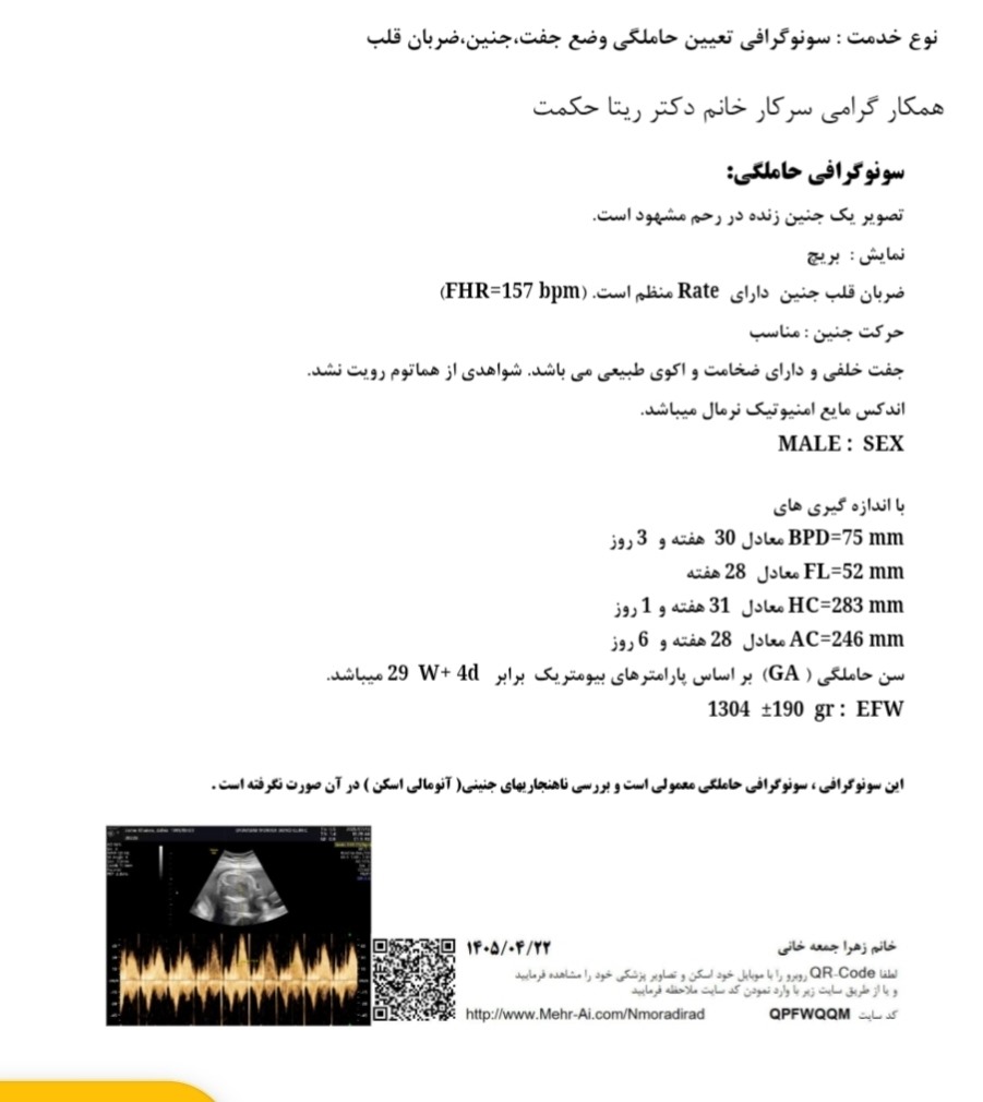 ۲۲بوده تاریخ انجامش