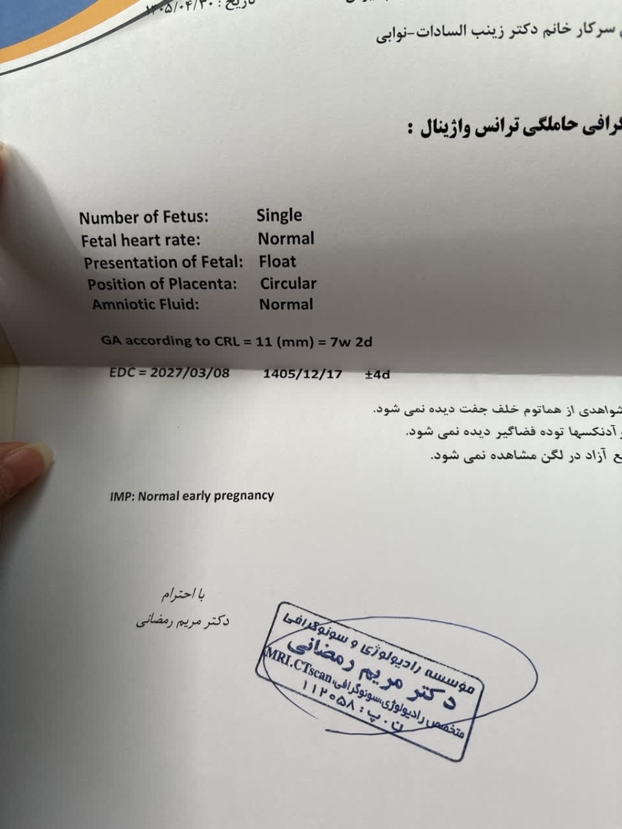 سونویی ک انجام دادم 30تیر سونویی ک انجام دادم 30تیر