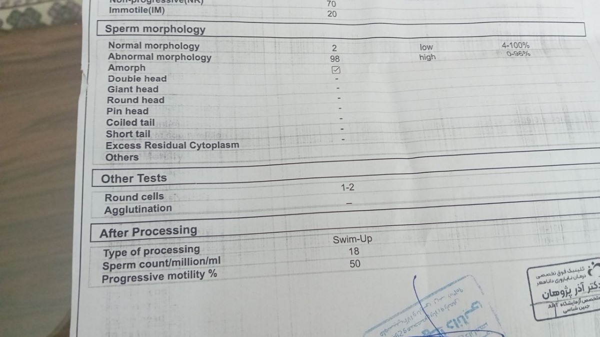 تفسیر آزمایش اسپرم